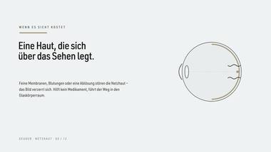 Netzhaut 03