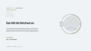 Netzhaut 08