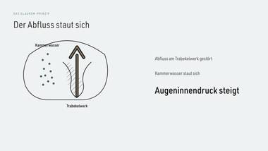 R055 · Vertiefung — ERKLÄR-DECK: Kammerwinkel & Abfluss