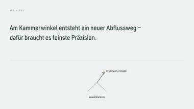 R055 · Abschluss — ERKLÄR-DECK: Kammerwinkel & Abfluss