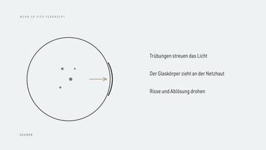 R065 · Vertiefung — ERKLÄR-DECK: Glaskörper-Anatomie
