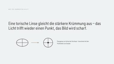 R075 · Abschluss — ERKLÄR-DECK: Astigmatismus (Hornhautverkrümmung)