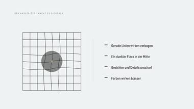 R085 · Vertiefung — ERKLÄR-DECK: Makuladegeneration (AMD)