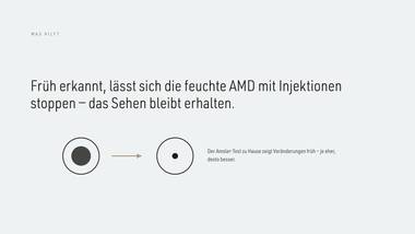 R085 · Abschluss — ERKLÄR-DECK: Makuladegeneration (AMD)
