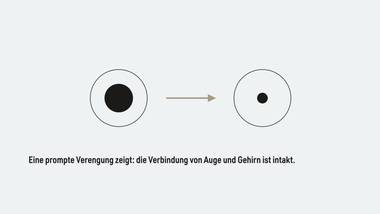 R095 · Abschluss — ERKLÄR-DECK: Pupillen-Lichtreaktion