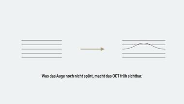 R100 · Abschluss — ERKLÄR-FINALE: OCT-Bildgebung